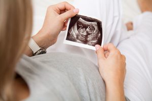 بهترین سونوگرافی آنومالی در تهران - کلینیک دکتر صانعی